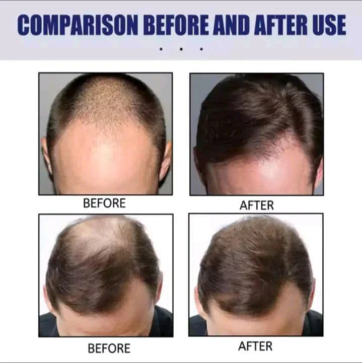 Dexe Hair Building Fiber Black 22gm - Instant Hair Thickening Solution
