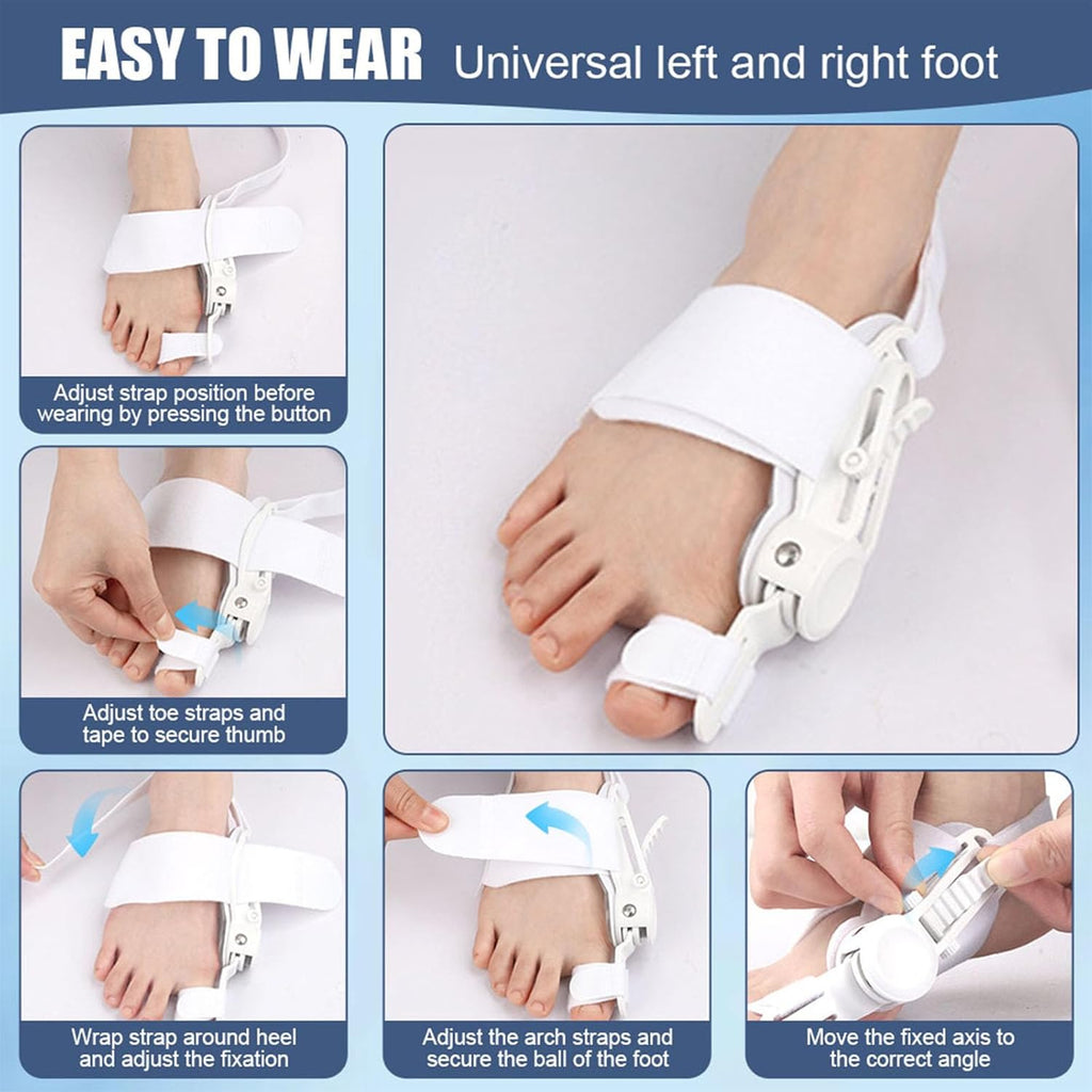 Fix Your Toe Without Surgery – Imported ⭐⭐⭐⭐⭐ (4.9/5) Ratings