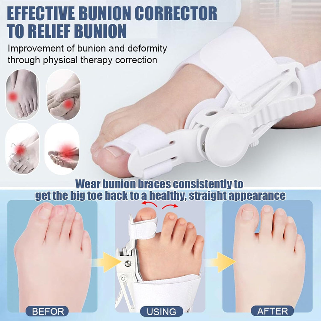 Fix Your Toe Without Surgery – Imported ⭐⭐⭐⭐⭐ (4.9/5) Ratings