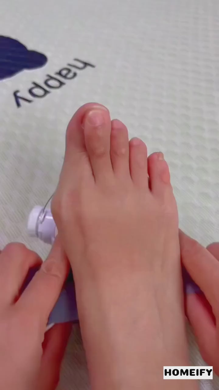 Fix Your Toe Without Surgery – Imported ⭐⭐⭐⭐⭐ (4.9/5) Ratings