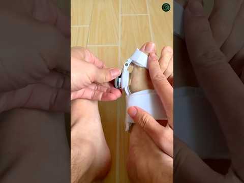 Fix Your Toe Without Surgery – Imported ⭐⭐⭐⭐⭐ (4.9/5) Ratings